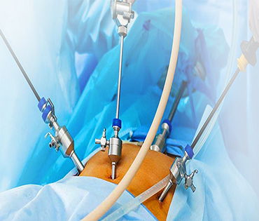 Best Laparoscopic Hospital in Tambaram